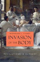 Invasion of the Body - Revolutions in Surgery