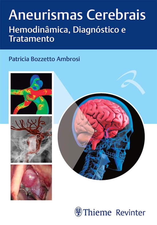 Aneurismas Cerebrais - cover