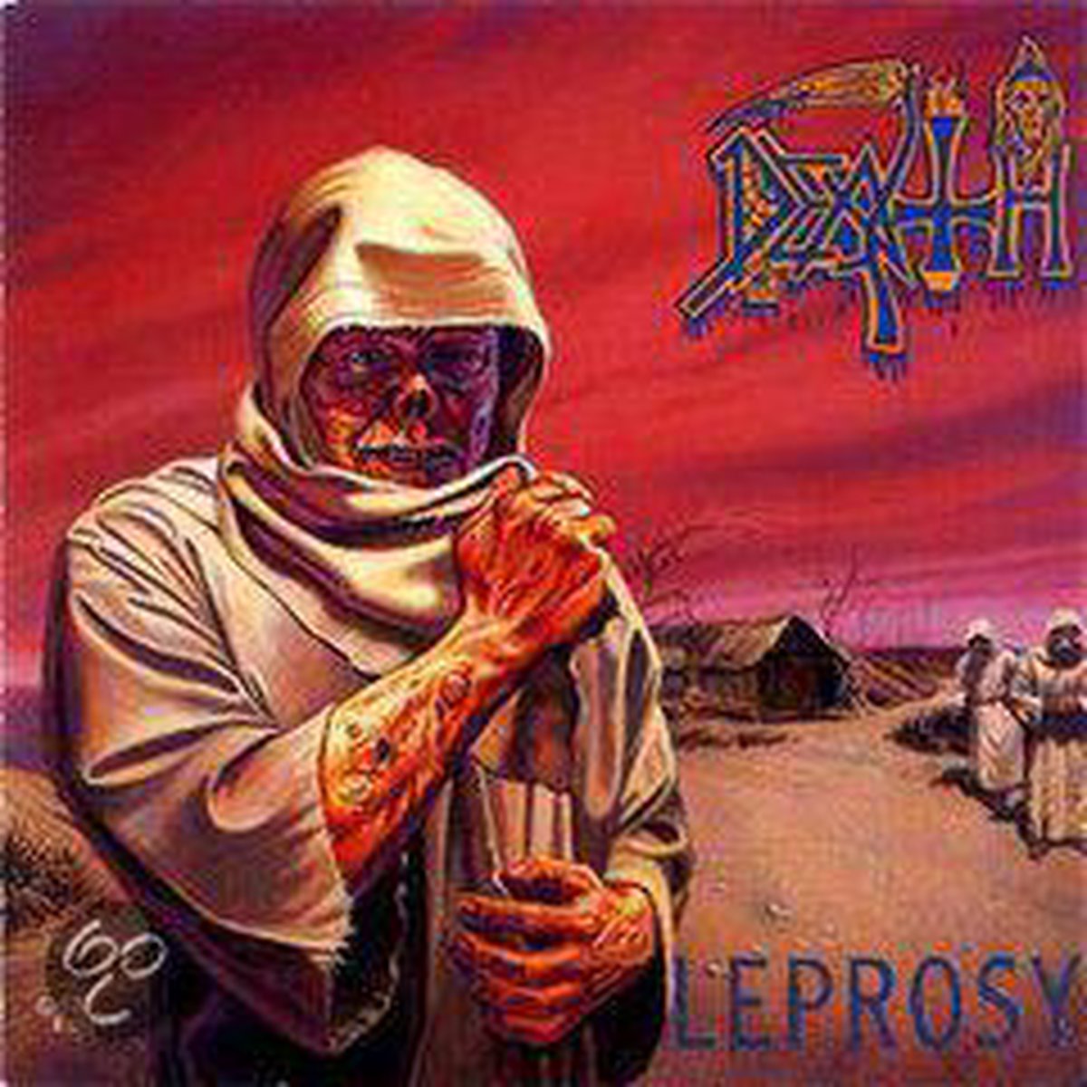 Leprosy