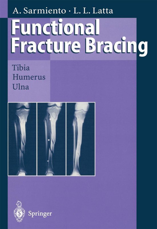 Medicine (R0) - Functional Fracture Bracing - cover