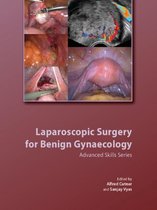 Laparoscopic Surgery for Benign Gynaecology Hardback with DVDs