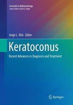 Keratoconus: Recent Advances in Diagnosis and Treatment