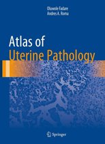Atlas of Anatomic Pathology - Atlas of Uterine Pathology