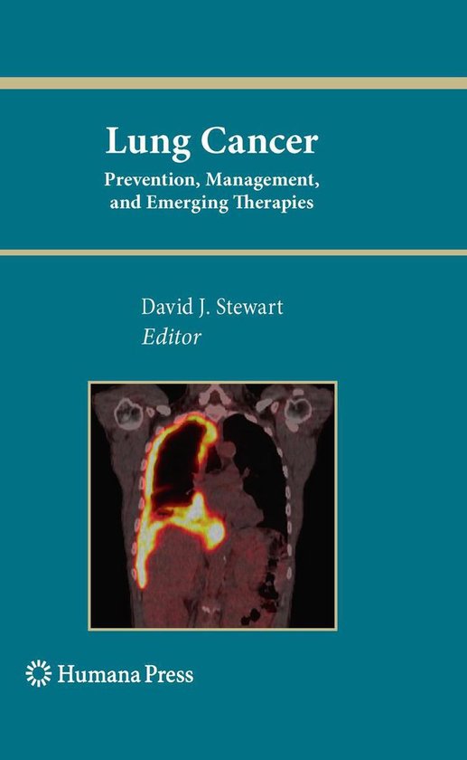 Medicine (R0) - Lung Cancer: - cover
