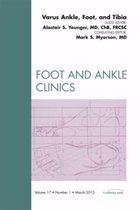 Varus Foot, Ankle, and Tibia,  An Issue of Foot and Ankle Clinics