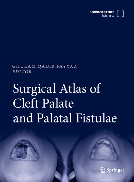 Surgical Atlas of Cleft Palate and Palatal Fistulae - cover