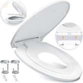 KESSER® Abattant WC avec couvercle à fermeture douce - Abattant WC également pour enfants avec Duroplast et fonction Quick-Release - Wit / Forme Familiale