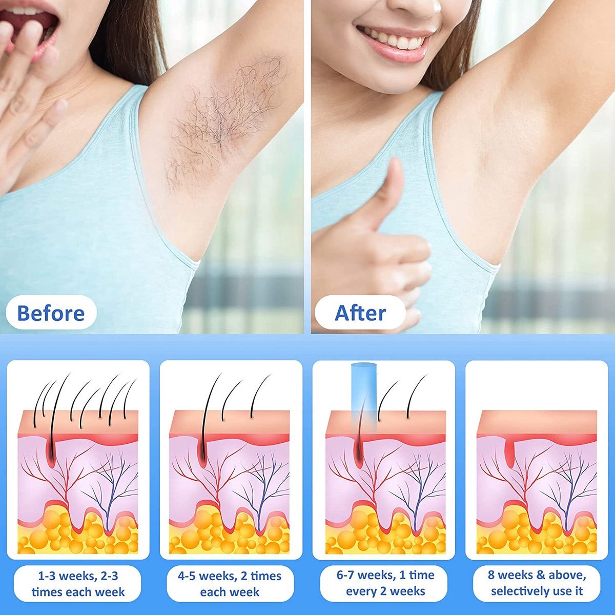 Beauty Kit Epilator Dames Ontharing \ Laserontharing \ ipl laser hair removal