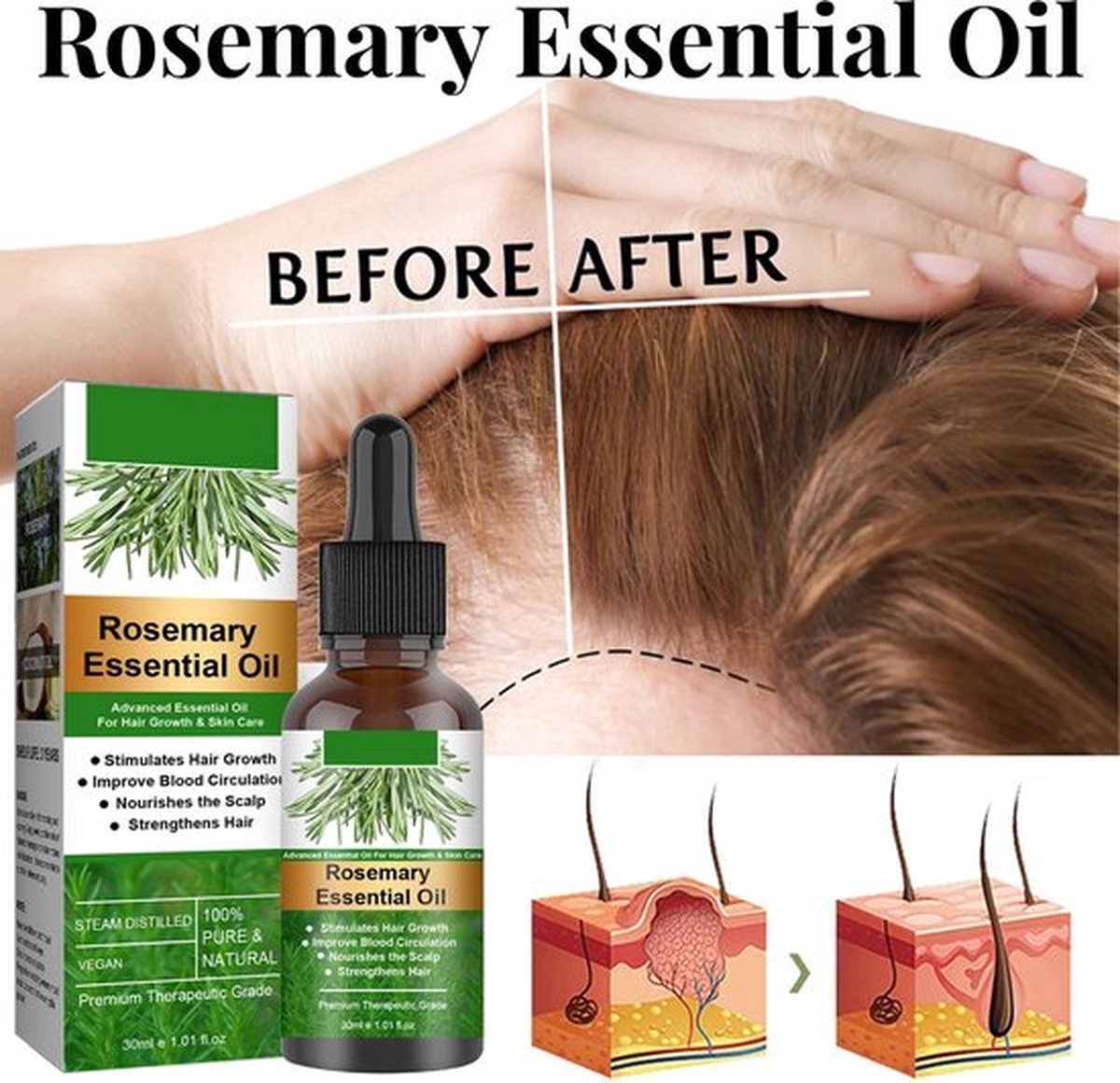 Gember Olie Hoofdhuid Massage Haarfollikel Serum Haarverzorging Essence Conditioner Haar, vermindert kroeshaar, voor alle haartypes, Haaruitval verminderen, dikker langer voller gezonder haar