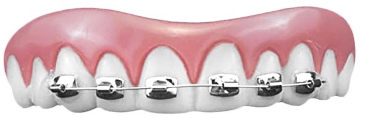 Kunstgebit InstantSmile Beugel versie Medium Boven gebit