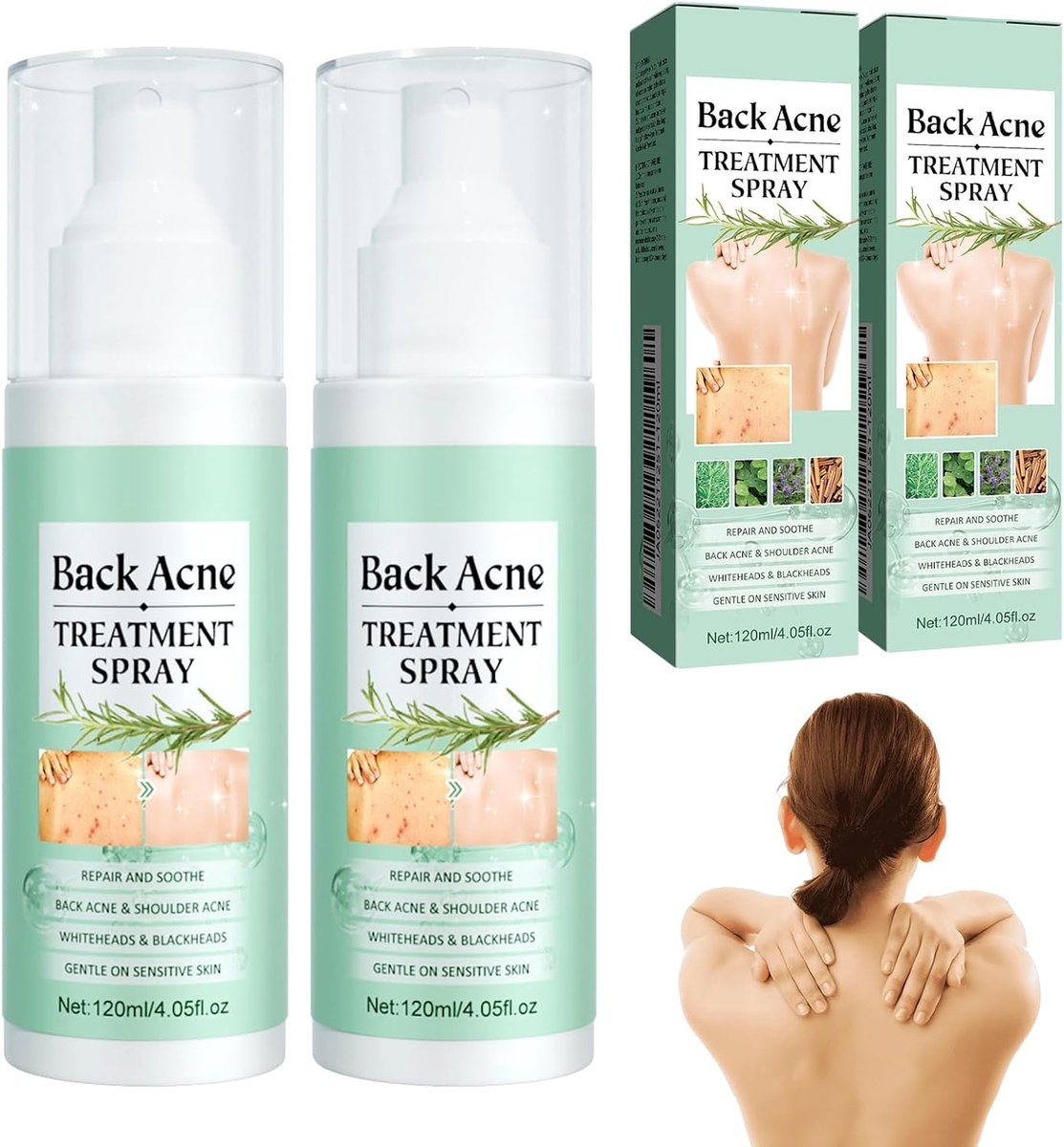 Acne spray voor lichaam, rug en borst - 2 stuks, effectief tegen puistjes en huidirritatie, huidvriendelijk