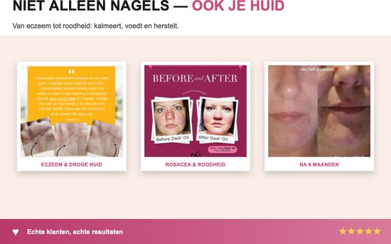 Drie afbeeldingen: handen met eczeem en droge huid, gezicht van vrouw met rosacea, gezicht 'na 6 maanden'.
