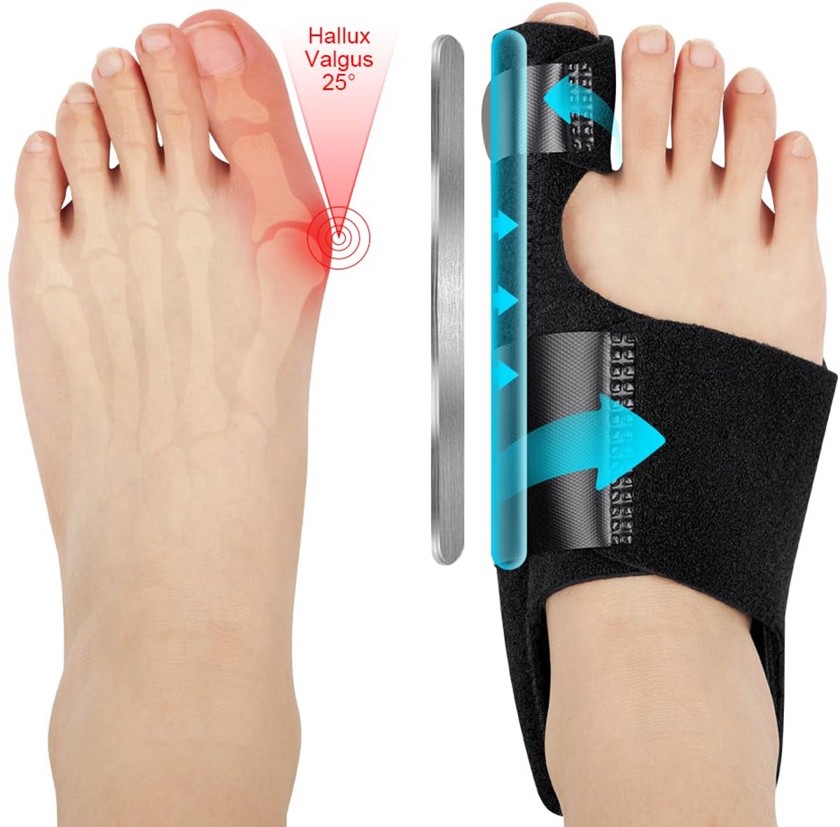 Sander Shop Bunion Corrector voor vrouwen en mannen, grote eeltknobbels corrector set met 2 x orthopedische eeltknobbels en 2 x grote teen stijltangen, verstelbare hallux valgus correctie voor dag/nacht