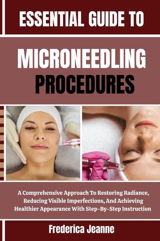 Essential Guide to Microneedling Procedures - cover