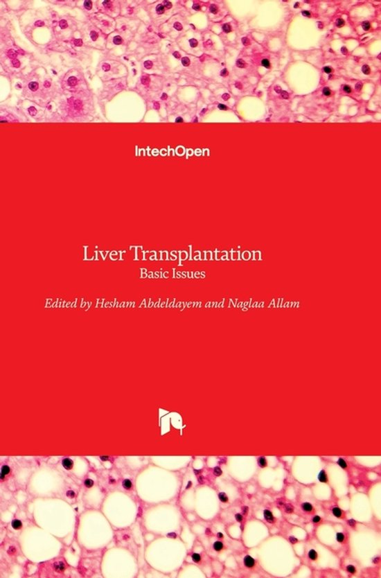 Liver Transplantation - cover