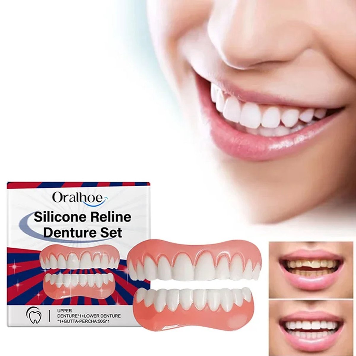 Tanden & Kunstgebit Reline Kit – Opvul Strips + Lijm – Spleten & Pasvorm