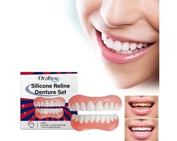 Tanden & Kunstgebit Reline Kit – Opvul Strips + Lijm – Spleten & Pasvorm