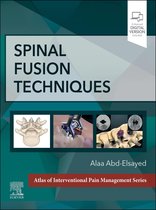 Spinal FusionTechniques