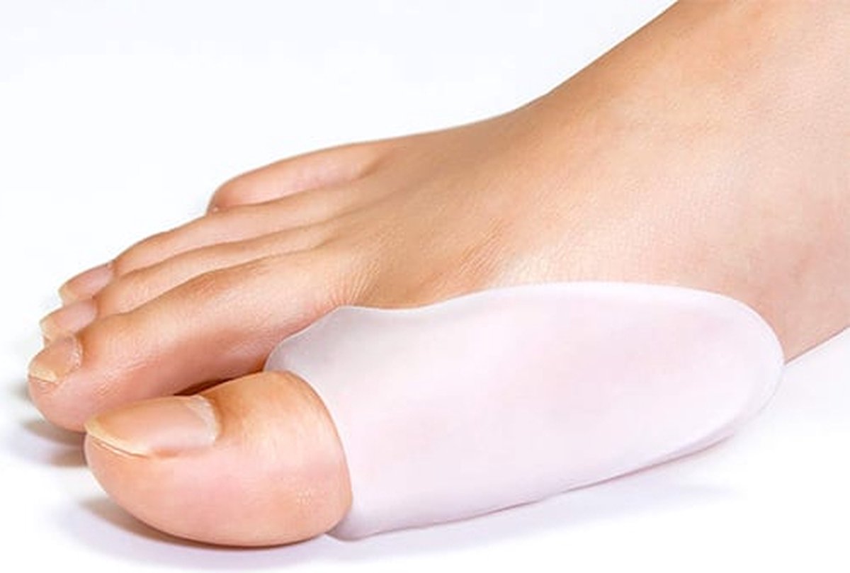 Medical Brace Knobbelbeschermer | Hallux Valgus Beschermer | 1 Paar | Maat: S/M - Schoenmaat: 35-40
