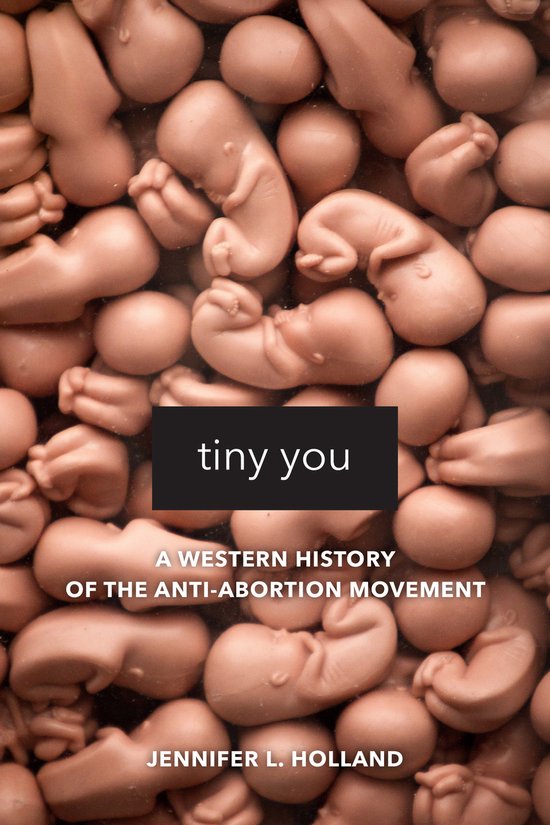 Tiny You – A Western History of the Anti–Abortion Moveme ... - cover