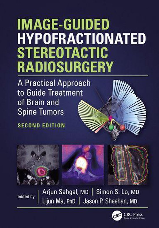 Image-Guided Hypofractionated Stereotactic Radiosurgery - cover