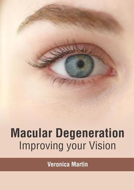 Macular Degeneration Improving Your Vision 9781632417091 Boeken