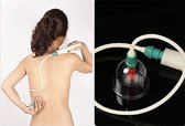 Massage cupping set - Traditional chinese medicine therapy