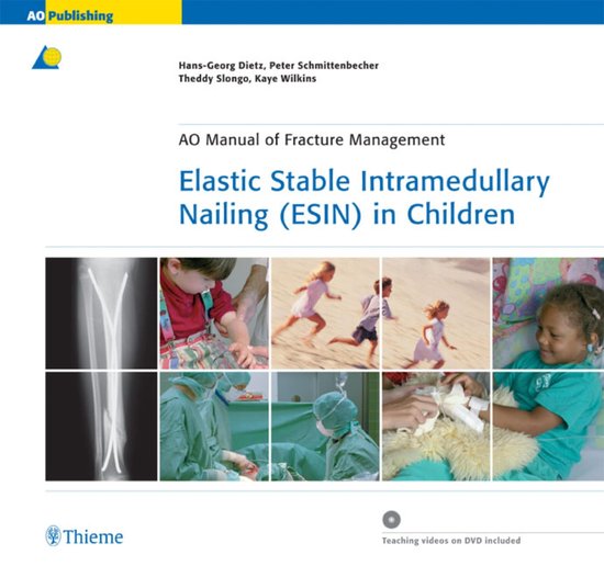 AO-Publishing - Elastic Stable Intramedullary Nailing (ESIN) ... - cover