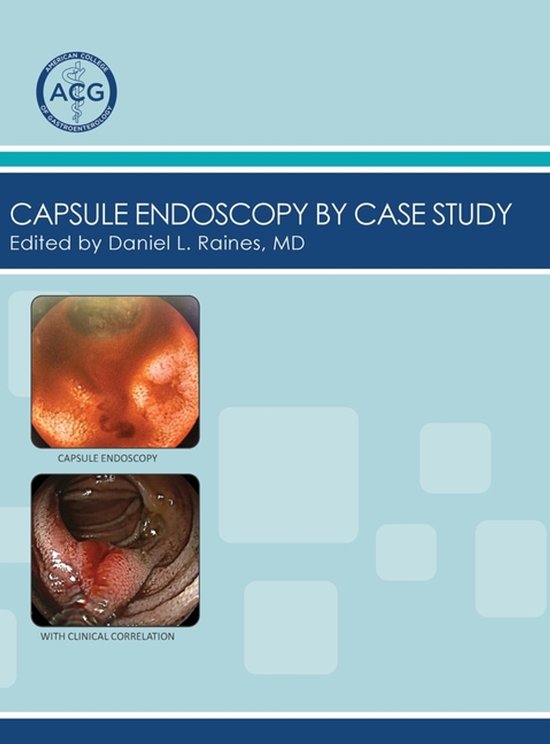 Capsule Endoscopy by Case Study, Volume 2 | 9798218747299 | Boeken | bol
