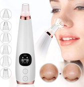 Blackhead Remover-met 5 Opzetstukken -Poriënreiniger