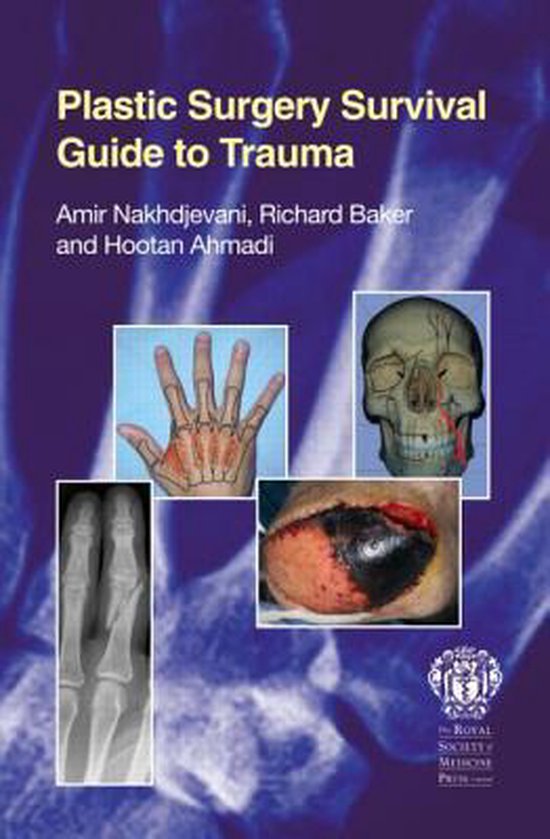 Plastic Surgery Survival Guide to Trauma 9781853157707 Amir