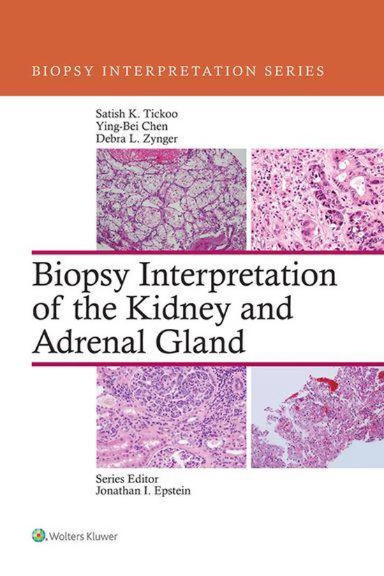Biopsy Interpretation of the Kidney & Adrenal Gland (ebook), Satish