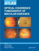 Atlas Optical Coherence Tomography Of Macular Diseases