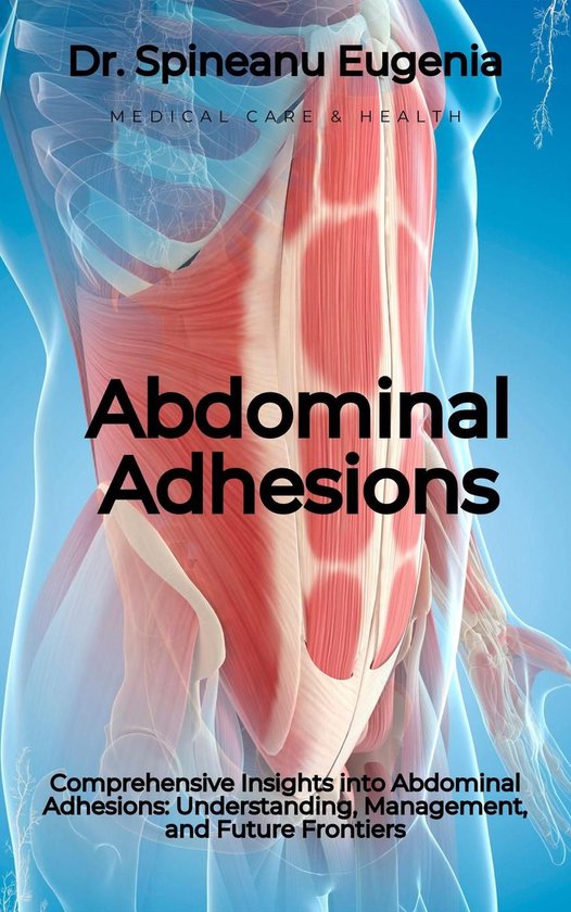 Comprehensive Insights Into Abdominal Adhesions Understanding comprehensive-insights-into-abdominal-adhesions-understanding