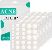 "300x Onzichtbare Acne Patches met Theeboomolie & Salicylzuur PIMPLE PATCH - De Ultieme Oplossing voor Puistjes!"