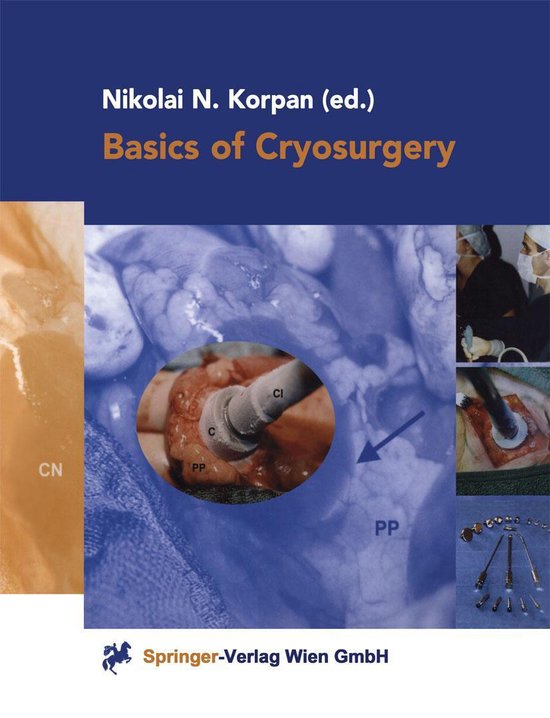 Basics of Cryosurgery - cover
