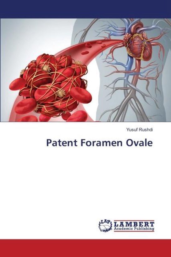 Patent foramen ovale