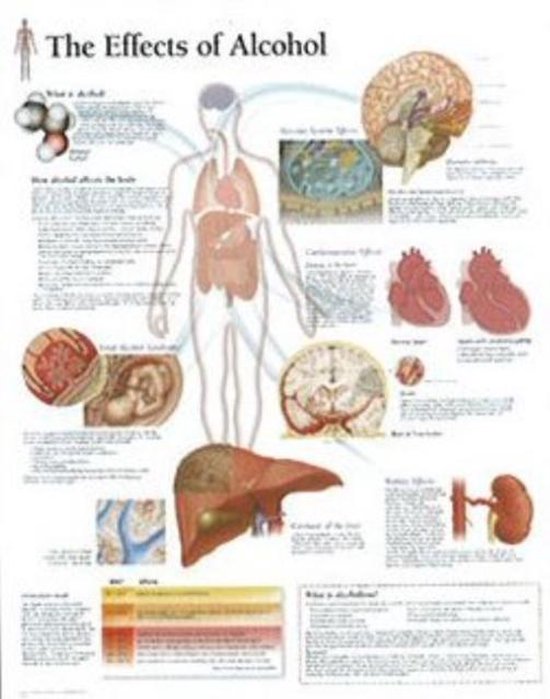 Foto: Effects of alcohol laminated poster