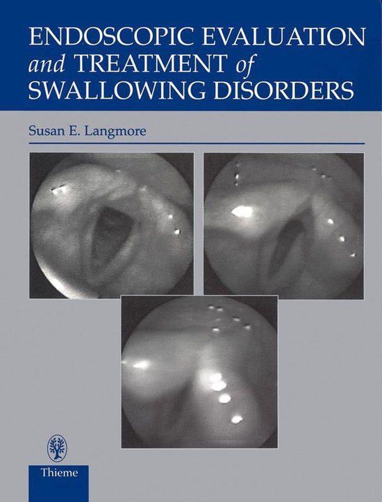 Endoscopic Evaluation and Treatment of Swallowing Disorders (ebook