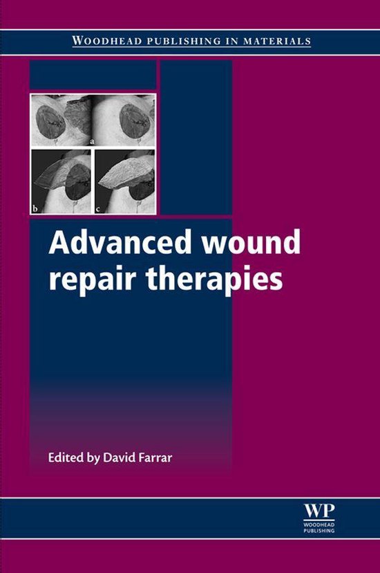 Advanced Wound Repair Therapies - cover