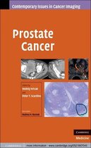 Contemporary Issues in Cancer Imaging -  Prostate Cancer