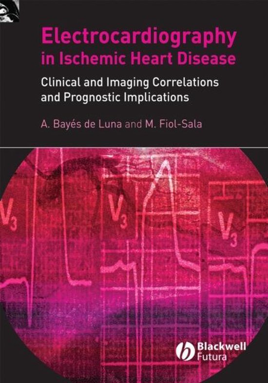 Electrocardiography In Ischemic Heart Disease 9781405173629 Antoni Bay S De Luna Bol