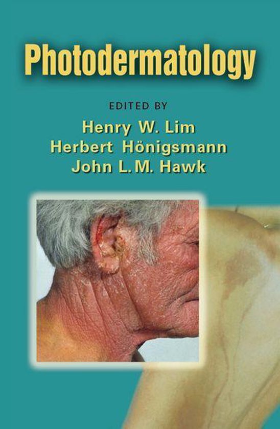 Photodermatology - cover