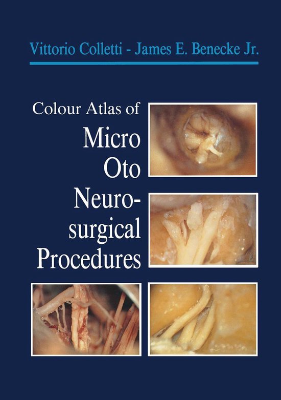 Colour Atlas of Micro-Oto-Neurosurgical Procedures - cover