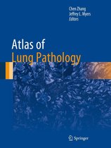 Atlas of Anatomic Pathology - Atlas of Lung Pathology