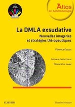 Stratégies Thérapeutiques Dans La Dmla Exsudative