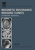 Breast MR Imaging, An Issue of Magnetic Resonance Imaging Clinics
