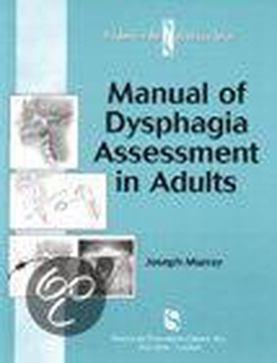 Manual of Dysphagia Assessment in Adults | 9781565938717 | Joseph ...