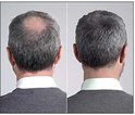 Voor en na: grijs haar dat voller lijkt na gebruik van IMPERIO haarvezels.