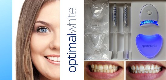 Chemicaliën Afdaling zonlicht Optimal White® Tandenbleekset - Thuis 100% Veilig Tanden Bleken - Witte  Tanden - Teeth... | bol.com